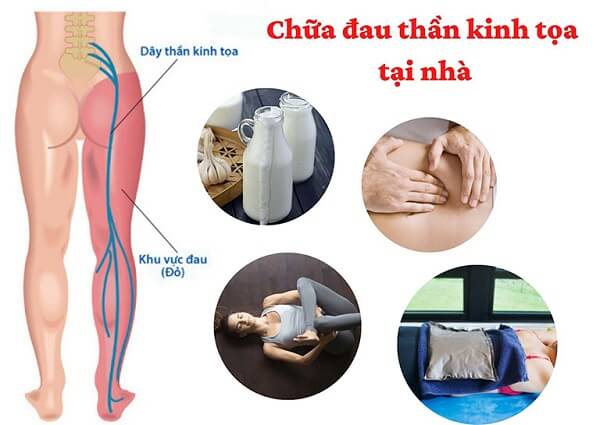 Cách massage khi bị đau nhức từ mông xuống bắp chân